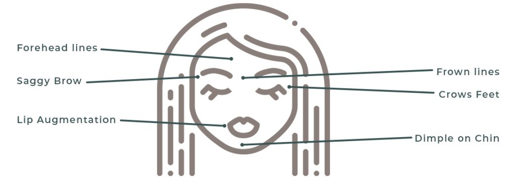 An illustration of a stylized face with arrows pointing to various areas labeled with text. The labels are: "Forehead lines," "Saggy Brow," "Lip Augmentation," "Frown lines," "Crows Feet," and "Dimple on Chin." The drawing, focused on facial aesthetics, is simple and uses minimal lines.